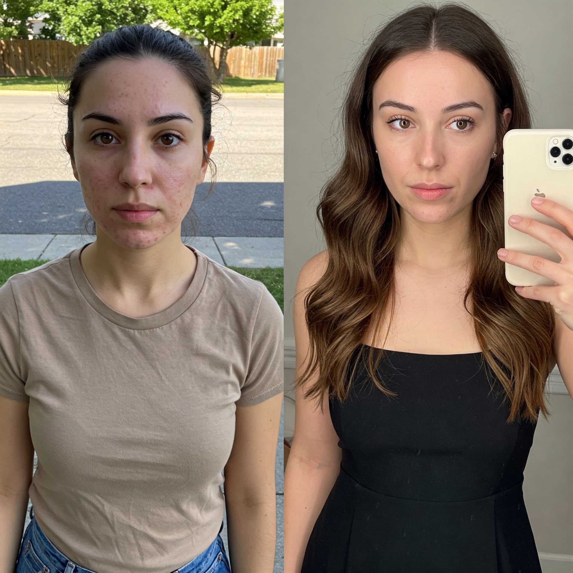 Female skin improvement before and after light therapy