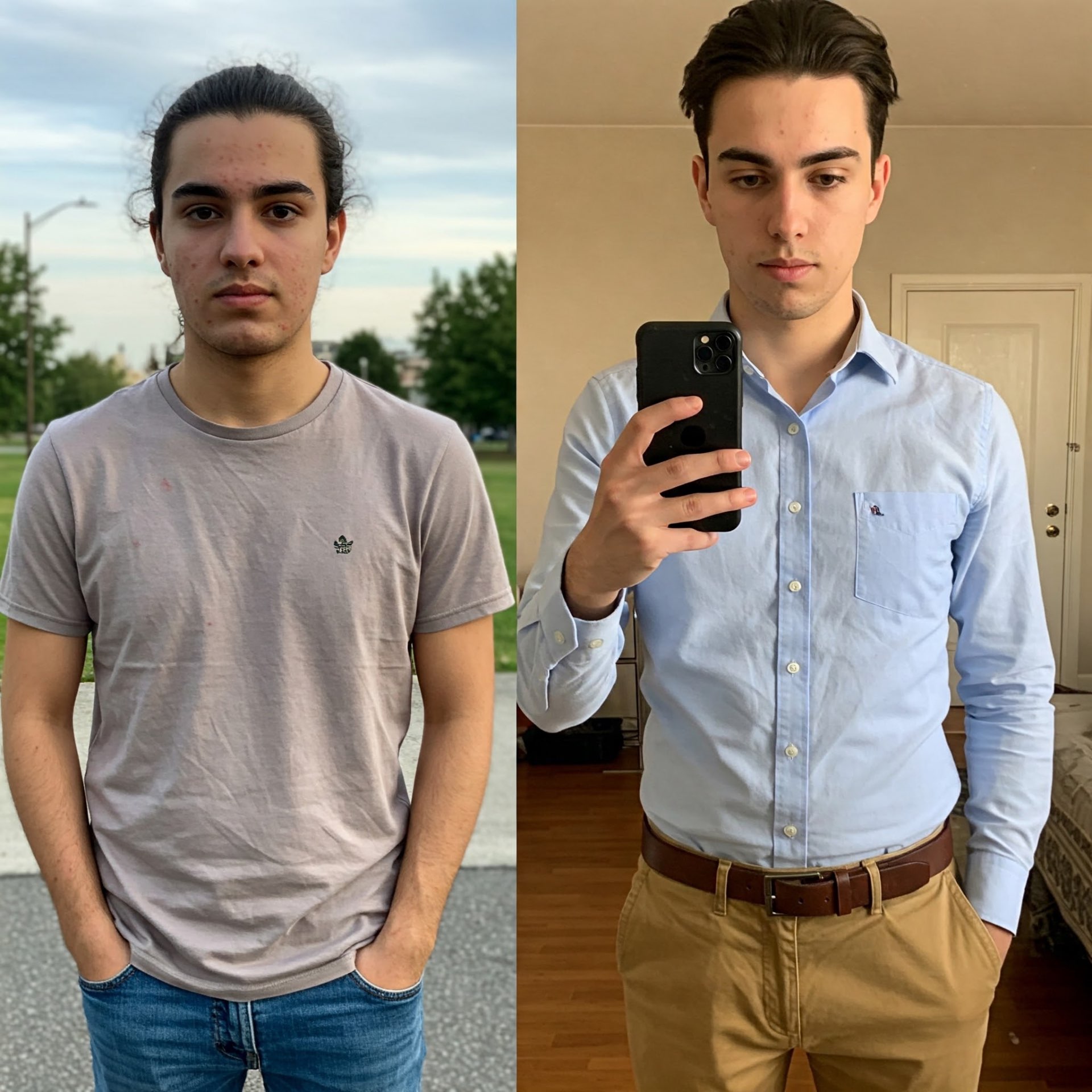 Skin improvement before and after light therapy