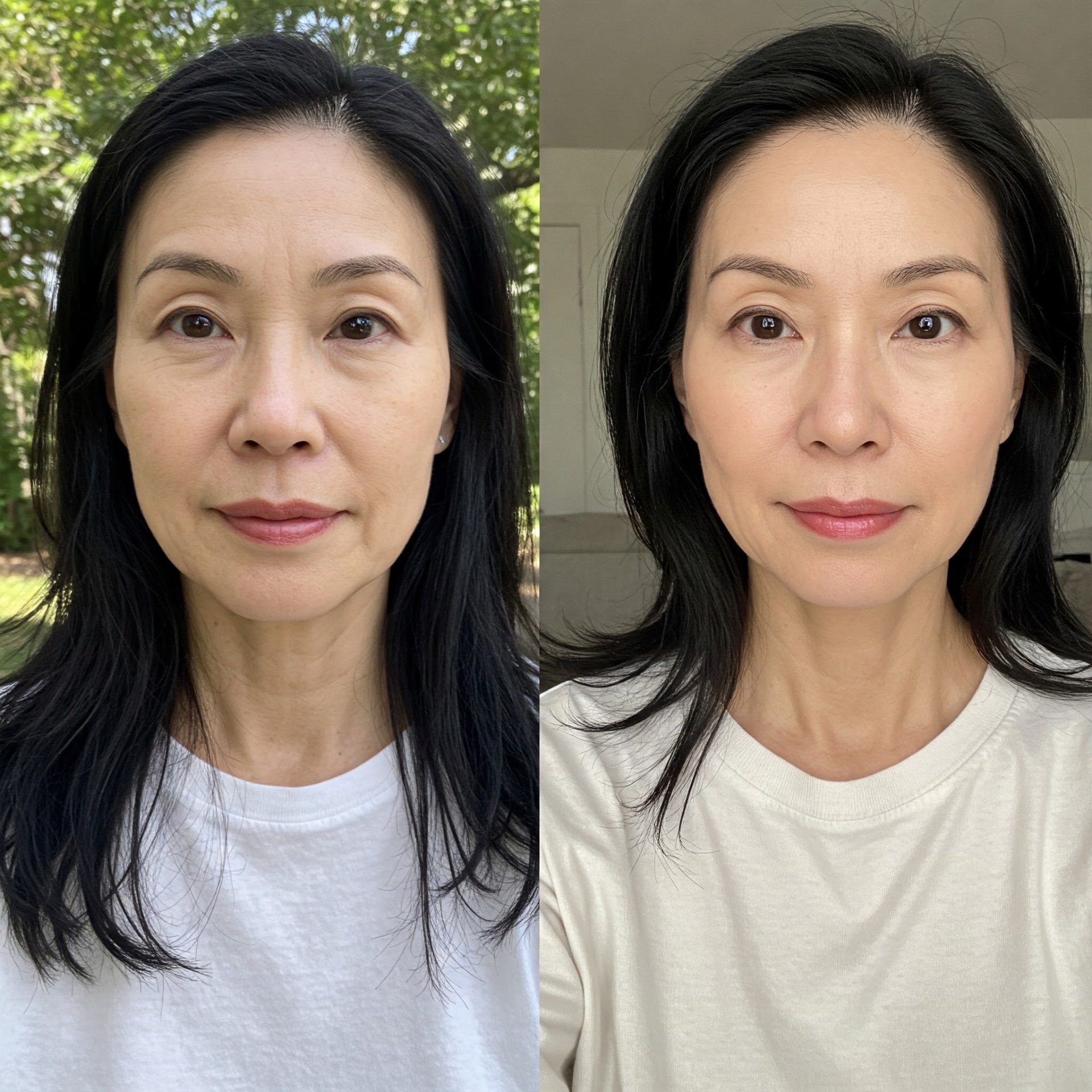Male facial improvement before and after light therapy